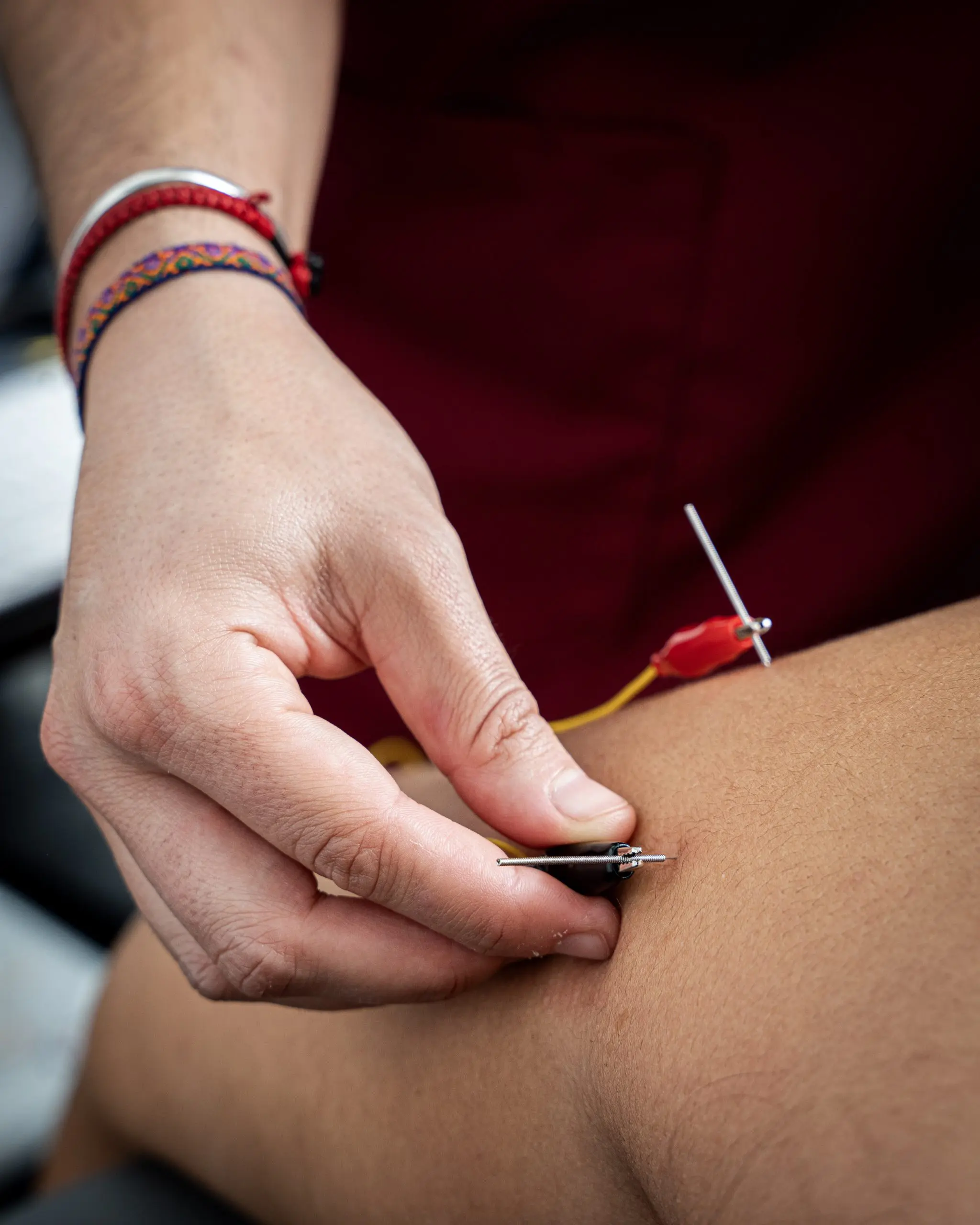 TƩcnicas invasivas de fisioterapia en Zutik OƱati